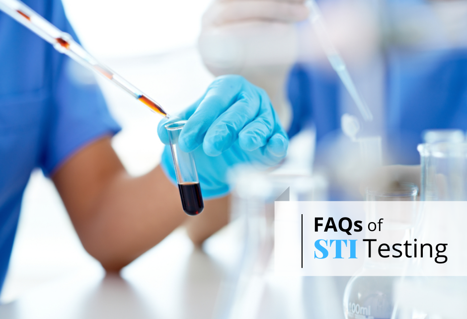 STI Testing Faqs