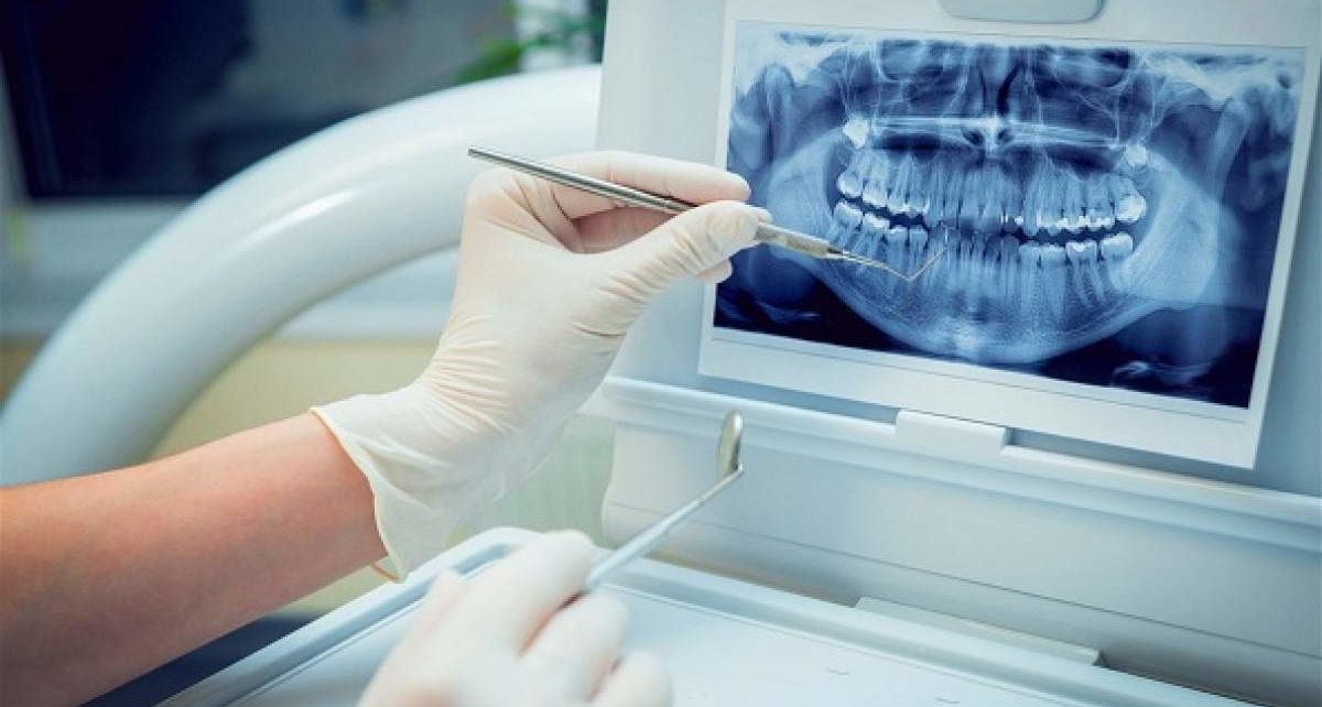 Dental Imaging Market