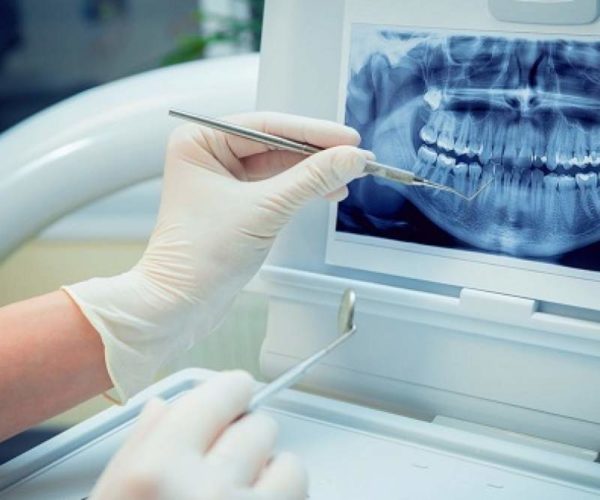 Dental Imaging Market
