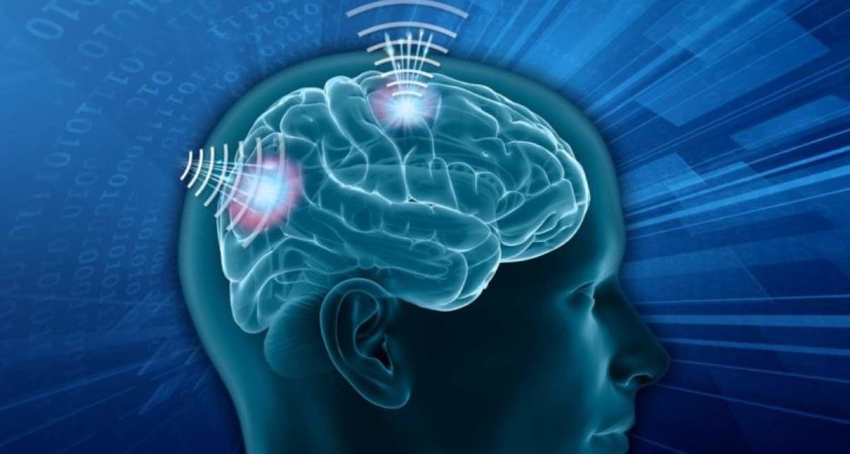 Wireless Brain Sensors Market