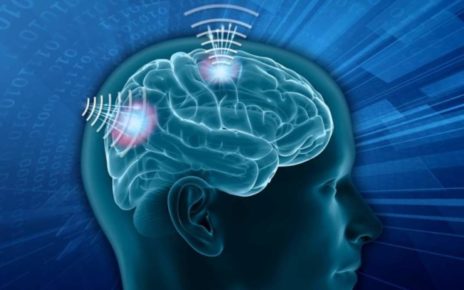 Wireless Brain Sensors Market