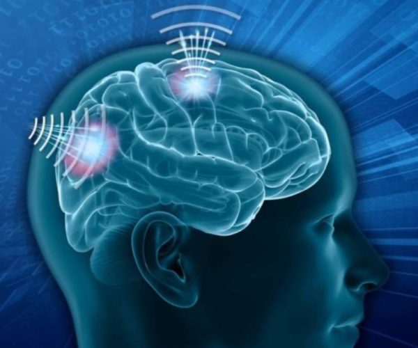 Wireless Brain Sensors Market