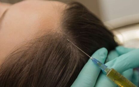 hair loss treatment Ludhiana.